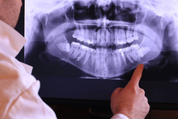 Best Emergency Treatment for Toothache in Sergeant Bluff, IA