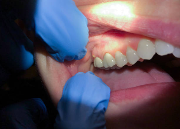 Best Pediatric Emergency Dentist in Sergeant Bluff, IA